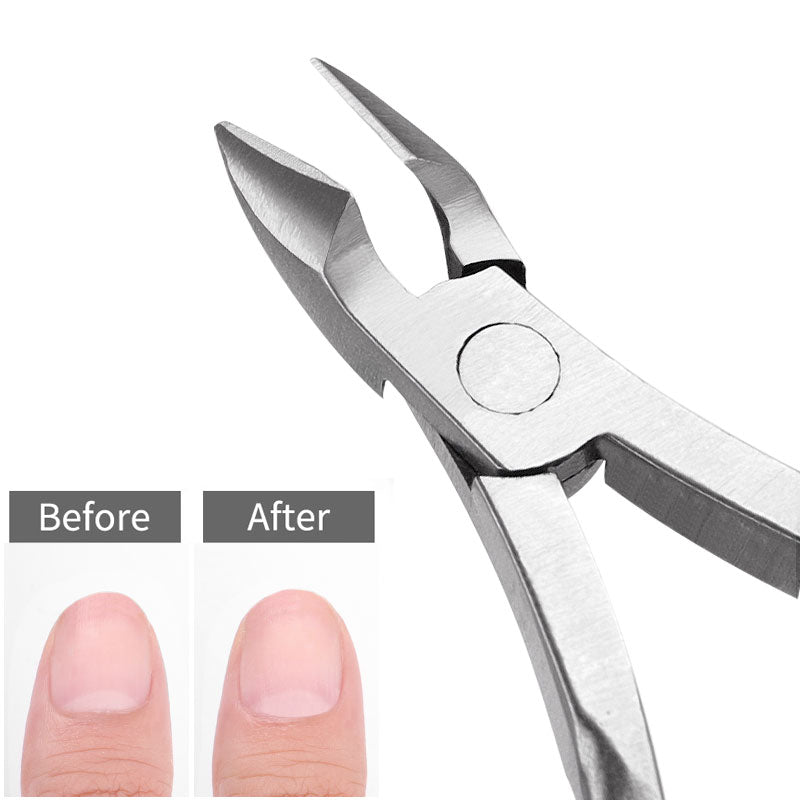 Cuticle Nipper